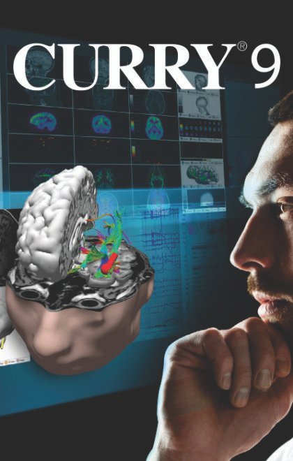 Curry 9 D – Software para Digitalização e Reconstrução 3D