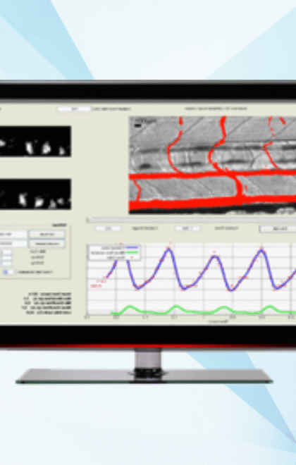 MicroZebraLab – Análise Cardiovascular em Zebrafish